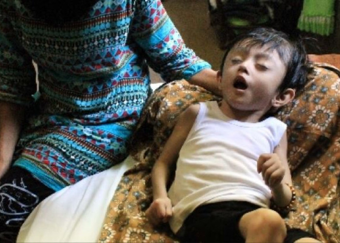 Jangan Diabaikan! Ini Tanda Anak Kurang Gizi yang Sering Terlewat Orang Tua
