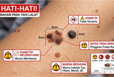 Kenali Tahi Lalat: Penyebab, Tanda Berbahaya, dan Cara Mengatasinya